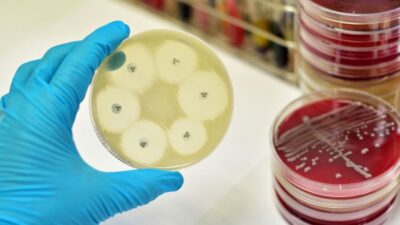 Resistensi Antimikroba